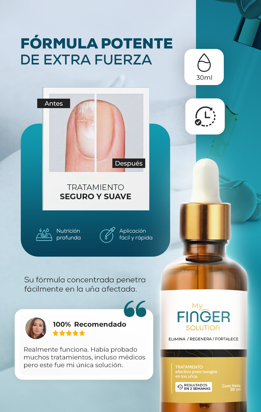 MY FINGER SOLUTION - ELIMINA HONGOS DE PIES Y UÑAS